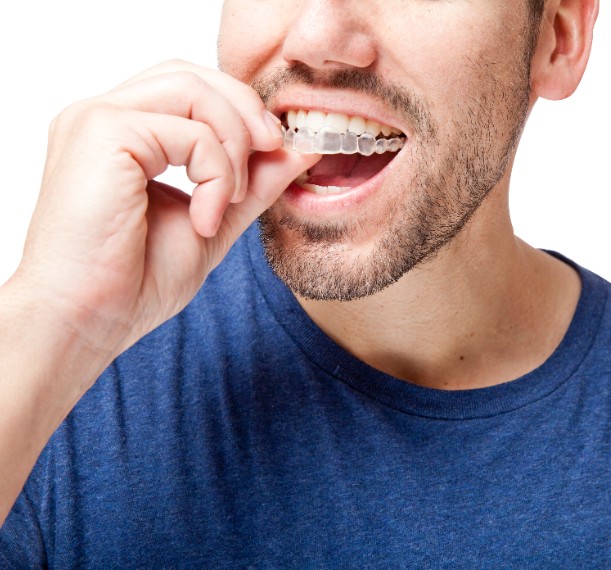 Barrie Dentist Invisalign